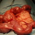 Pyometra cystozní změna na vaječnících